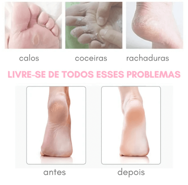 FootCleanPro® Lixa Elétrica Portátil Removedora de Calos e Rachaduras dos Pés + E-book de Brinde